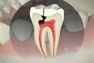 Endodontics